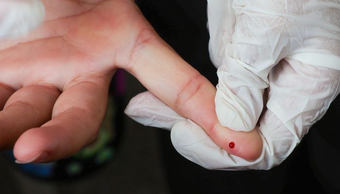 © Fabio Rodrigues-Pozzebom/ Agênc